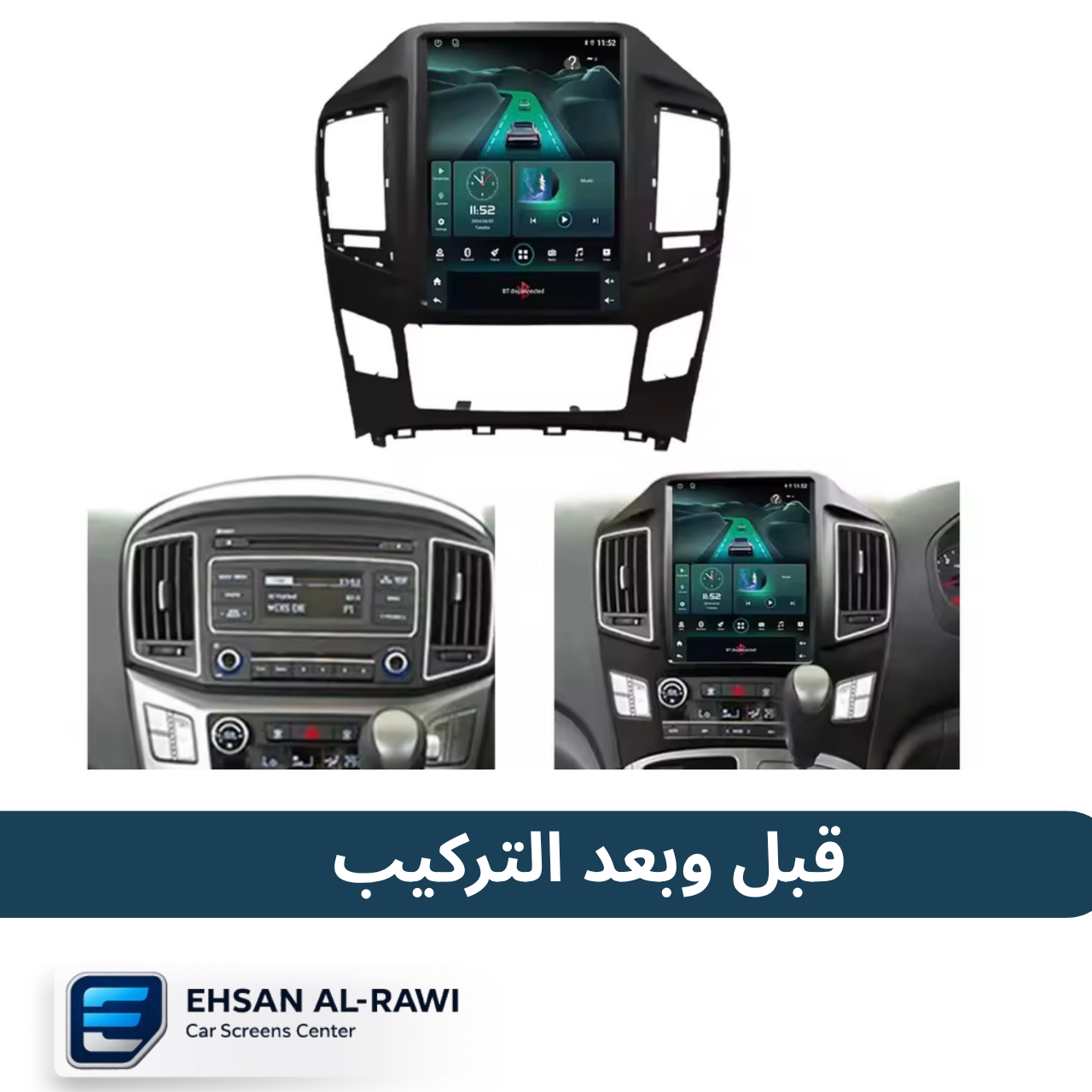شاشة ستاراكس التسلا (2016-2020) بنظام اندرويد